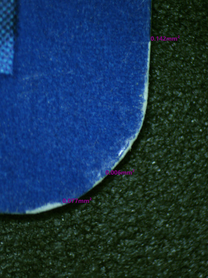 00984 IRIS Grading Card